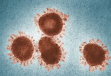 Izbruh enega najbolj smrtonosnih virusov nipa: Zdravstvena kriza – smrtnost 75%!!!