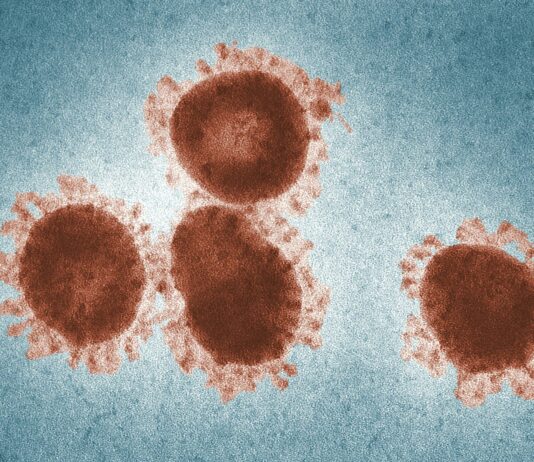 Izbruh enega najbolj smrtonosnih virusov nipa: Zdravstvena kriza – smrtnost 75%!!!